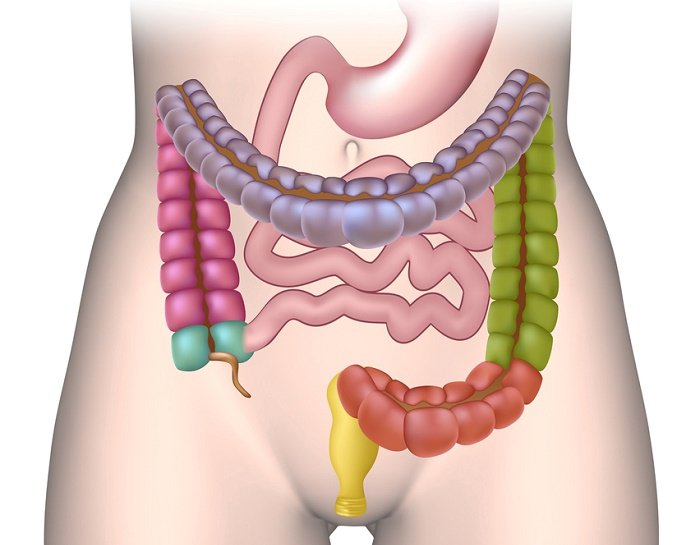 5 signs you have a perforated intestine