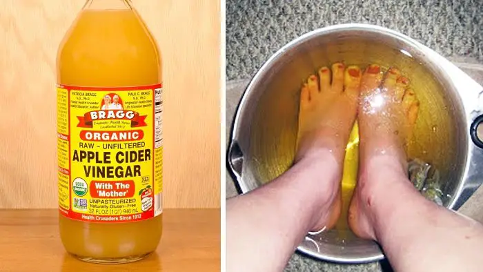 soaking your feet in vinegar