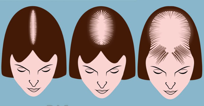 hair disorders and what they mean